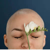 Alopecia Awareness Month 2026: Raise and Shine