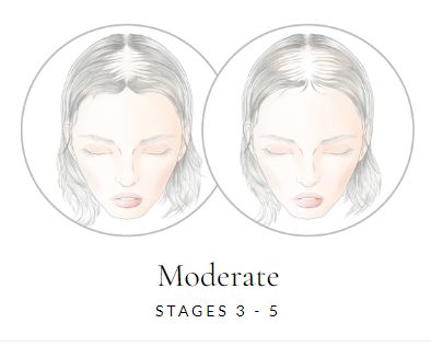 Gilded 12" Human Hair Mono Topper by Raquel Welch - Valentine Wigs