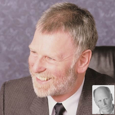 Microthin Toupee Men's Collection By Dimples - Valentine Wigs