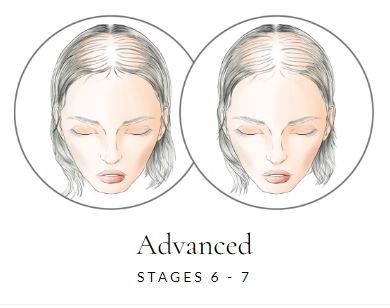 Special Effect Mono Base Lace Front Human Hair Top Piece by Raquel Welch - Valentine Wigs